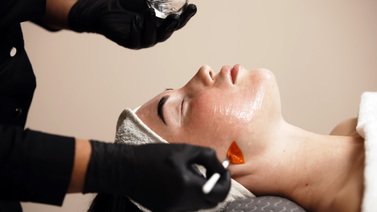 Featured image for Are Chemical Peels Actually Good for Your Skin